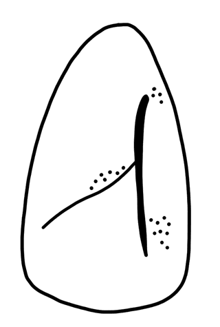 Tracing of HT Wa 1720