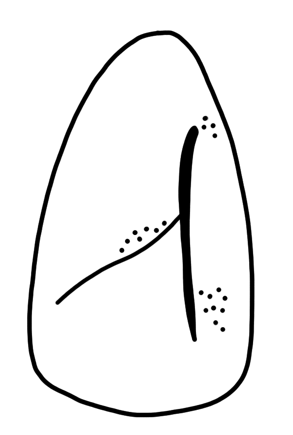 Tracing of HT Wa 1720